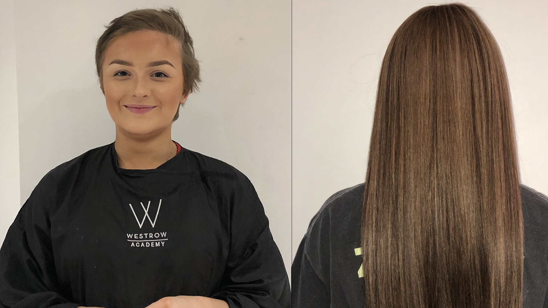 Unlimited Hairloss Solutions Reveals The Life Changing Effects Of